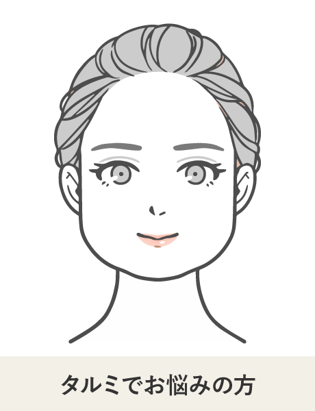 こんな方におすすめ たるみ