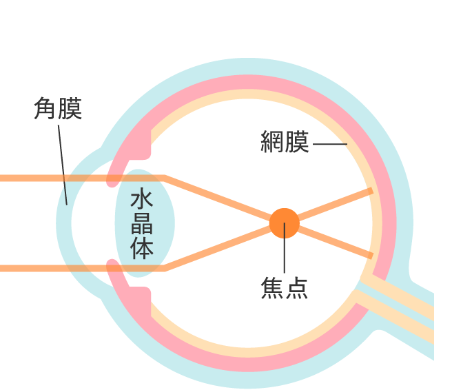 治療の仕組み 就寝前にレンズを装着