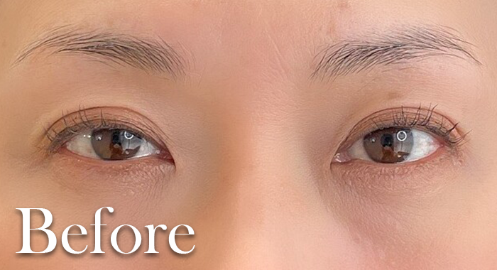 眉アートメイクbefore